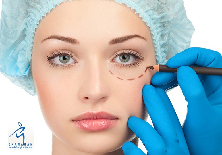 Everything You Need To Know About Eyelid Surgery