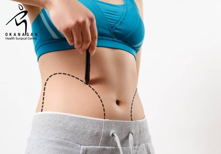 The Quest for a Tighter Tummy … Which Tummy Tuck is Best for Me?