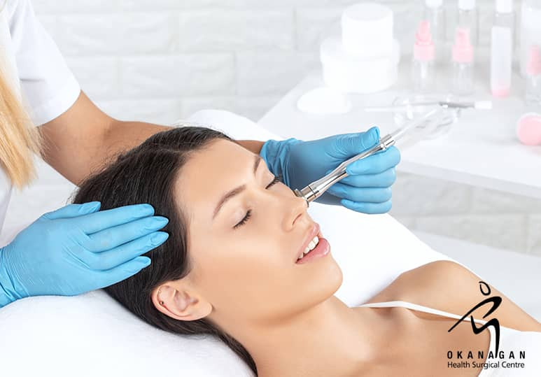 Okanagan Health Surgical - The Uses And Benefits Of Dermabrasion