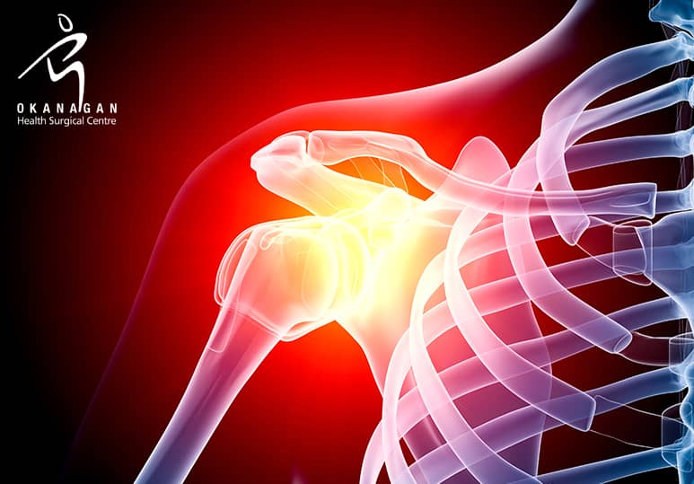 Are You A Candidate For Minimally Invasive Arthroscopic Shoulder Surgery?