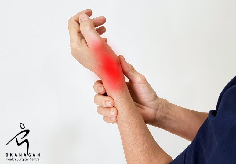 Understanding Carpal Tunnel Release Surgery: A Step-by-Step Guide