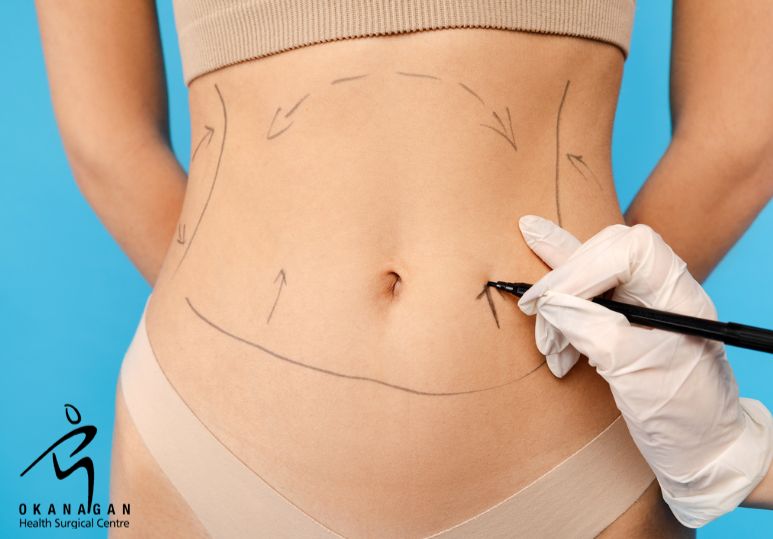 Kelowna Abdominal Surgery: Common Abdominal Conditions and How Surgery Can Help