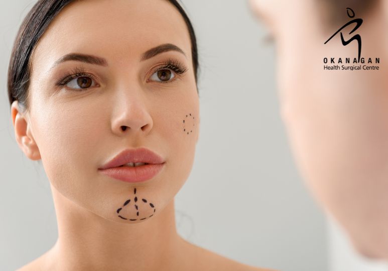 5 Reasons Why British Columbia Residents Are Opting for Face Surgery